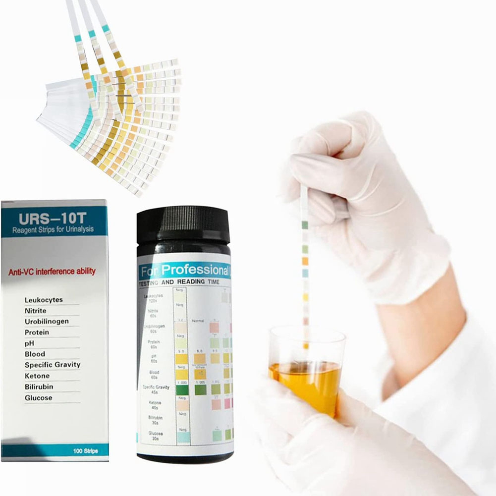 Strisce Reattive per Test di Z - Urine Analyzer Strip recensione e prezzo